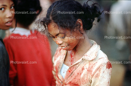 Woman Covered in Blood, Andapa, Madagascar