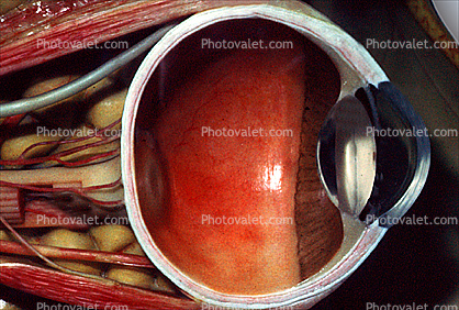 Lens, Cornea, Cross section, Eyeball, iris, pupil, veins, Round, Circular, Circle, Sclera