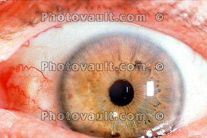 Eyeball, Iris, Lens, Pupil, Eyelash, Cornea, Sclera
