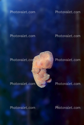 Human Embryo, 6 weeks, Fetus, Embryo