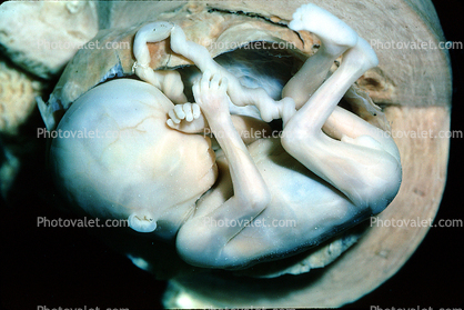 Human Embryo, Fetus, Embryo