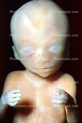 Human Embryo, Fetus, Embryo