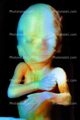Fetus, Embryo, Embryology, Fetal Development