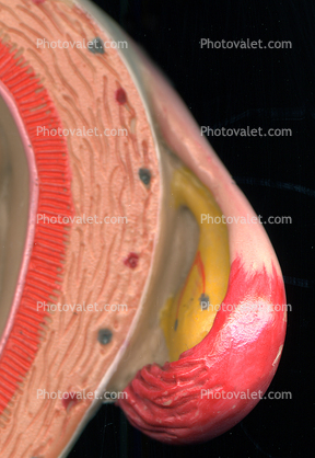 fallopian tube