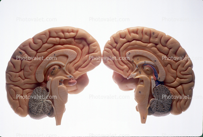 Cross Section of a Brain, Two Halves