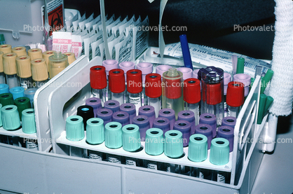 Blood Samples, lab