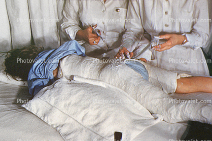 Patient in a body cast, 1949, 1940s, Spicacast
