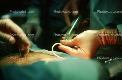 Operating Room, Doctor, Surgery, Surgeon, surgical gloves