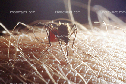 Mosquito, BIG and BAD and Thirsty, full with human blood, Skin Texture, Hair, Alaska