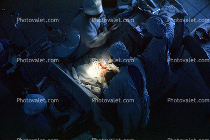 Ceasarian Section Operation, China, China Hospital, Surgery, Surgeon