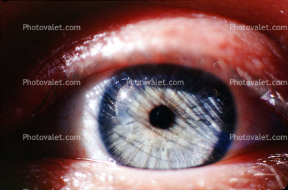 Eyeball, Iris, Lens, Pupil, Eyelash, Cornea, Sclera, Male, Man
