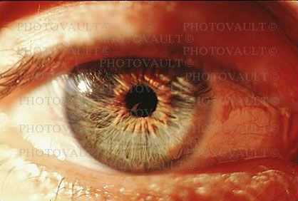 Eyeball, Iris, Lens, Pupil, Eyelash, Cornea, Sclera, Man, Male