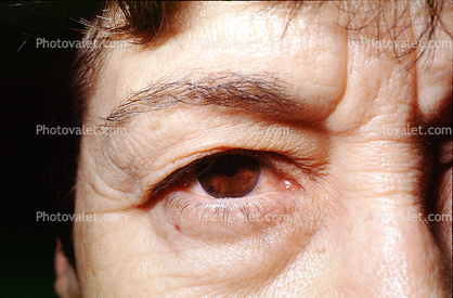 Eyeball, Iris, Lens, Pupil, Cornea, Sclera, Woma, Female, Eye Brow, Eyebrow, Eyelash, skin