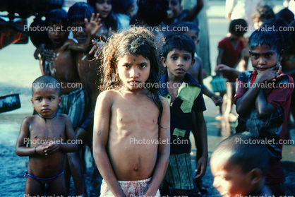 Malnourished Girl, Malnutrition, Hungry, Ribs, Slums