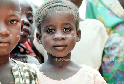 Adorable African Girl, Eyes