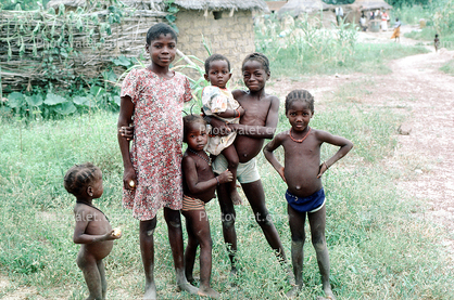 Group of Malnourished Children
