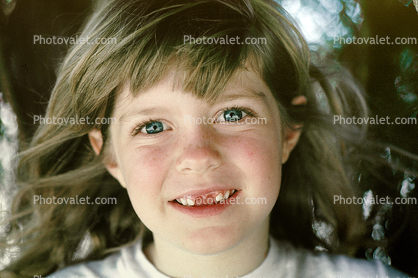 Girl, smiles, face, missing-teeth