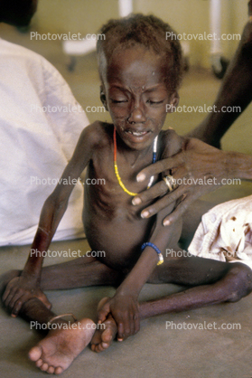 Mothers Hand, Starving LIttle Boy, Lake Turkana, refugee, African Diaspora