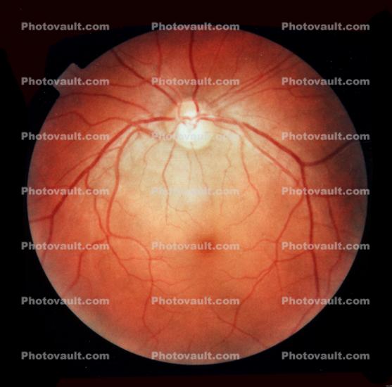 Cornea, Fovea, Macula, Retina, Optic Disk, Veins, Retinal Blood Vessels, Round, Circular, Circle