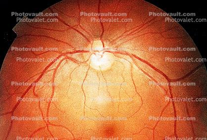 Cornea, Fovea, Macula, Retina, Optic Disk, Veins, Retinal Blood Vessels