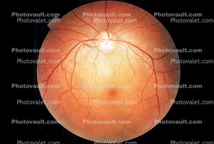 Cornea, Fovea, Macula, Retina, Optic Disk, Veins, Retinal Blood Vessels, Round, Circular, Circle