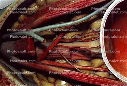 optical nerves, Cross section, Sclera