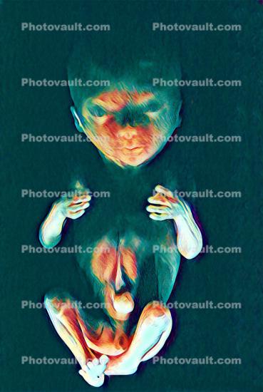Embryonic Presence, embryo