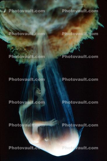 Human Embryo, Fetus, Embryo, Amniotic fluid