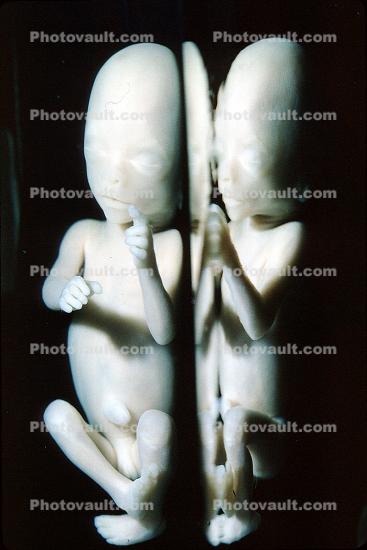 Human Embryo