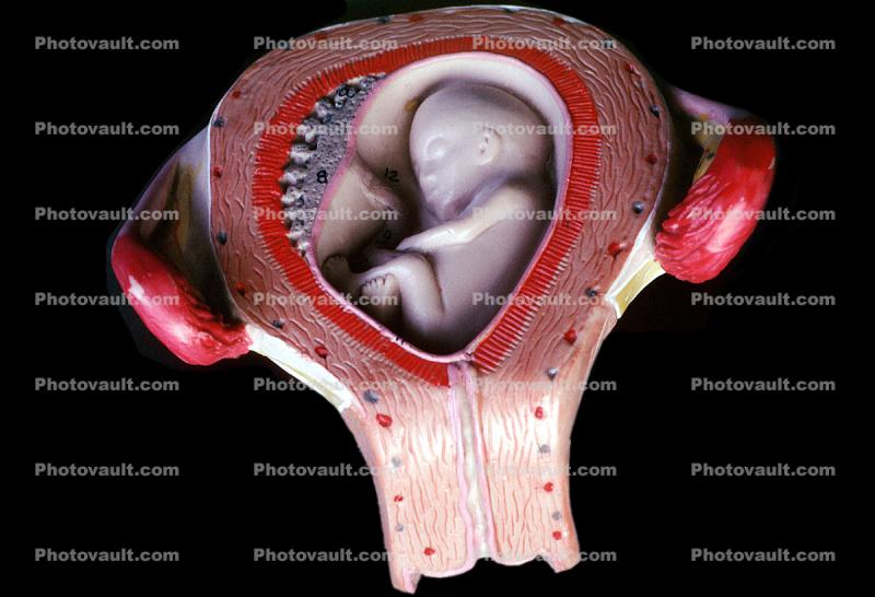 Cervix, Fallopian Tubes, Uterus
