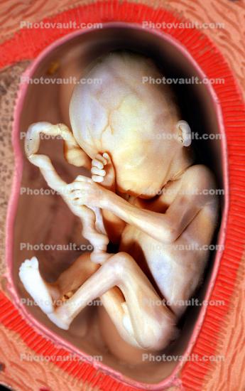 Womb, Uterus, Fetus
