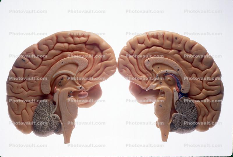 Cross Section of a Brain, Two Halves