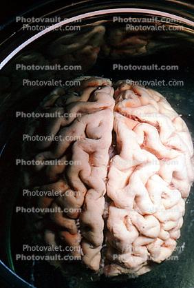 Real Human Brain