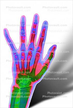 hand, fingers, X-Ray