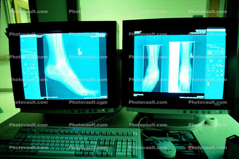 x-ray, foot, feet