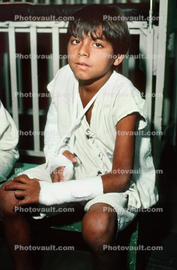 Boy with an Arm Cast, Broken Bone, Male