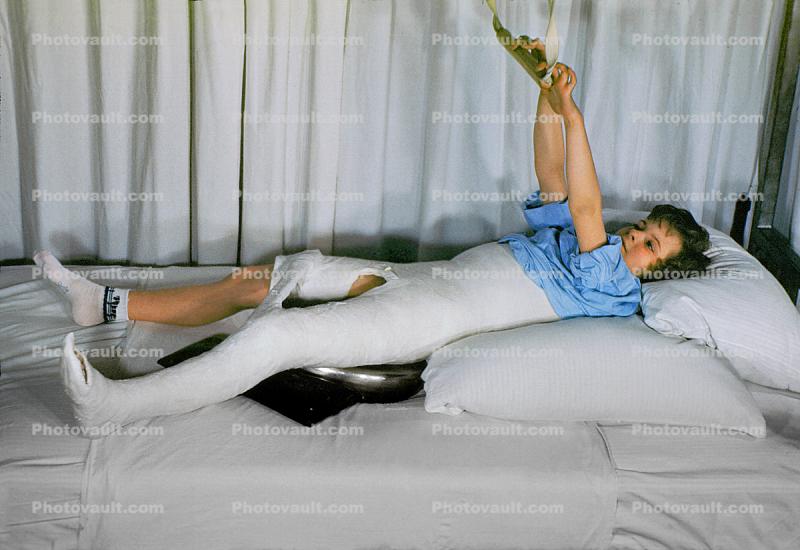 girl, bed, Spicacast, Patient in a body cast, Bedpan, 1949, 1940s