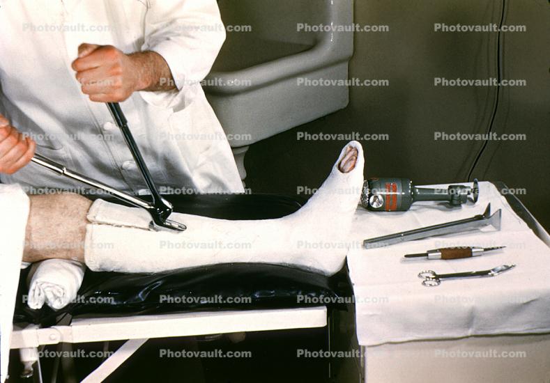 Patient in cast, Leg, Foot, Cutting, Doctor, Plaster Cast, 1949, 1940s