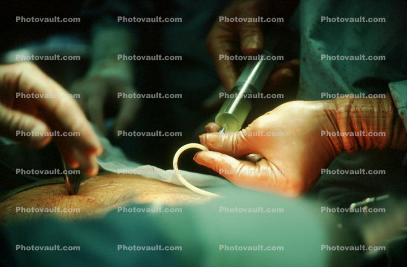 Operating Room, Doctor, Surgery, Surgeon, surgical gloves