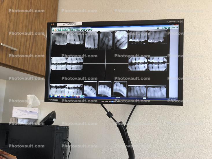 Dentist Office, Dental X-Ray Records, Computer Monitor