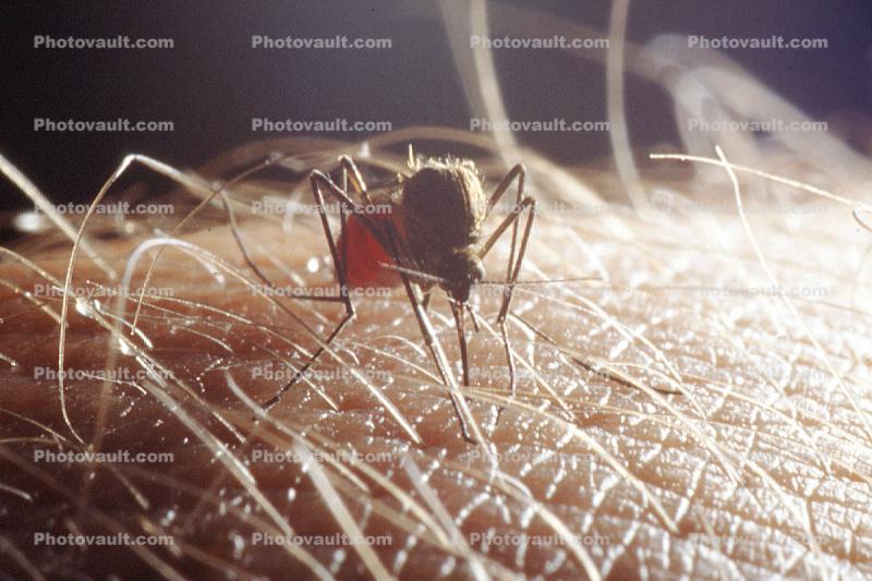 Mosquito, BIG and BAD and Thirsty, full with human blood, Skin Texture, Hair, Alaska