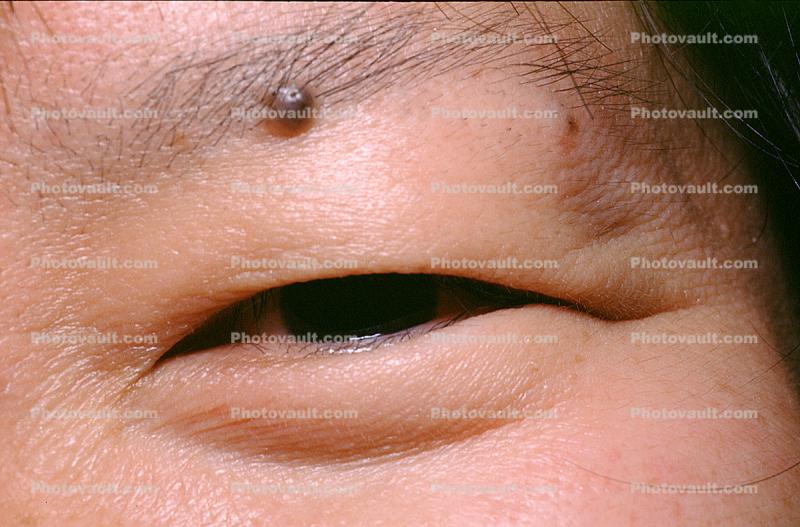 Eyeball, Iris, Lens, Pupil, Asian, Cornea, Sclera, Man, Male, skin, Eye Brow, Eyebrow