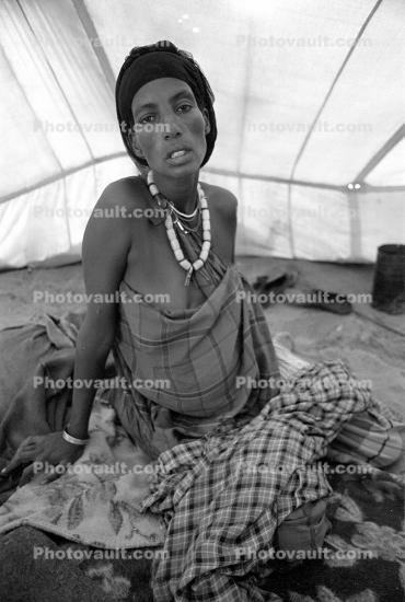 Tuberculosis, Refugee Camp, near the Ethiopia Somalia border, African Diaspora, Somalia