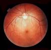Cornea, Fovea, Macula, Retina, Optic Disk, Veins, Retinal Blood Vessels, Round, Circular, Circle, HAEV01P01_18.0143