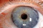 Lens, Cornea, Eyeball, iris, pupil, Round, Circular, Circle, Sclera, HAEV01P03_16
