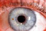 Eyeball, Iris, Lens, Pupil, Eyelash, Cornea, Sclera, Round, Circular, Circle, HAEV01P04_04