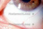 Eyeball, Veins, Sclera, HAEV01P04_08