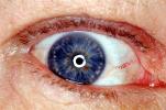 Eyeball, iris, msucles, veins, sclera