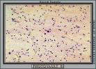Sperm cells, HAIV01P02_01