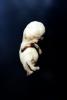 Fetus, Embryo, HAIV01P03_09